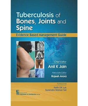 TUBERCULOSIS OF BONES JOINTS AND SPINE (HB 2017) By JAIN A K