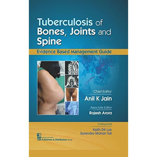 TUBERCULOSIS OF BONES JOINTS AND SPINE (HB 2017) By JAIN A K