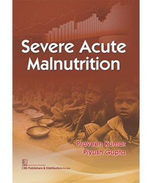 SEVERE ACUTE MALNUTRITION (PB 2017) By KUMAR P.