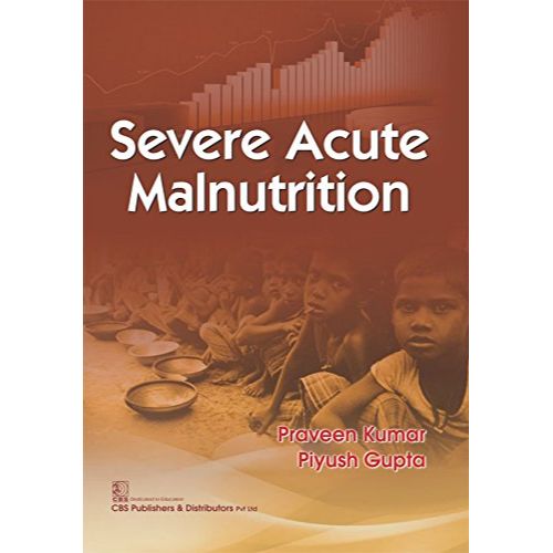 SEVERE ACUTE MALNUTRITION (PB 2017) By KUMAR P.