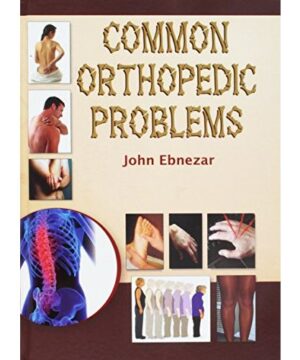 Common Orthopedic Problems By John Ebnezar