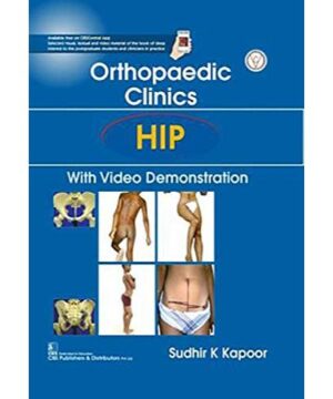 Orthopedic Clinics: Hip: With Video Demonstration By Sudhir K. Kapoor