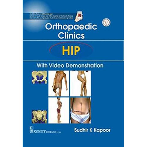 Orthopedic Clinics: Hip: With Video Demonstration By Sudhir K. Kapoor