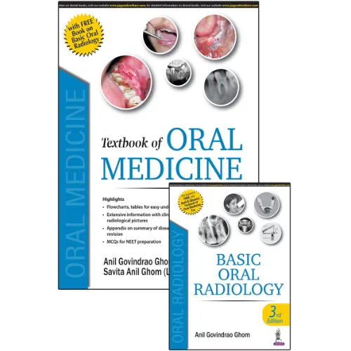 Textbook of Oral Medicine (With Free Book on Basic Oral Radiology) By Editors: Anil Govindrao Ghom
