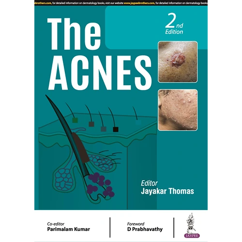 The Acnes By Thomas Jayakar, 2nd Edition