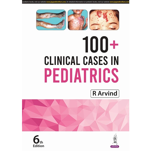 100+ Clinical Cases in Pediatrics by R Arvind, 6th Edition