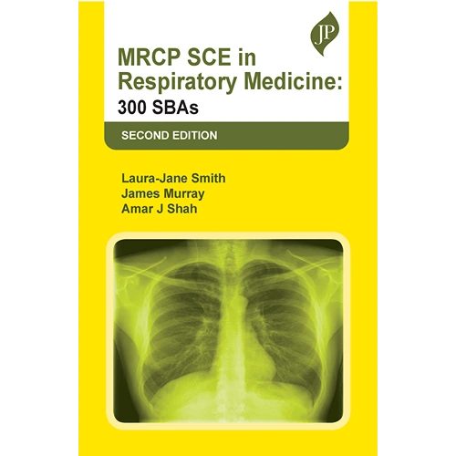 MRCP SCE in Respiratory Medicine: 300 SBAs by Laura-Jane Smith, 2nd Edition