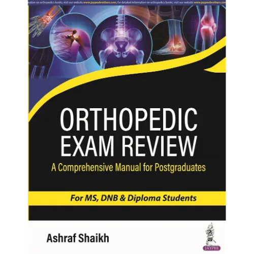 Orthopedic Exam Review: A Comprehensive Manual for Postgraduates for MS, DNB & Diploma Students by Ashraf Shaikh