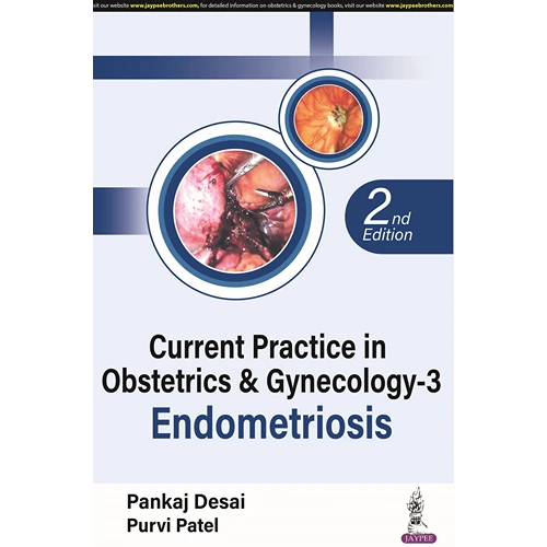 Current Practice in Obstetrics & Gynecology-3 Endometriosis by Pankaj Desai, 2nd Edition