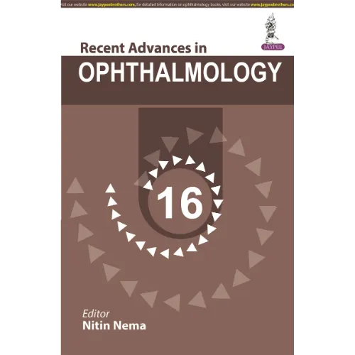 Recent Advances in Ophthalmology 16 by Nitin Nema