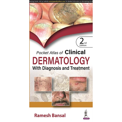 Pocket Atlas of Clinical Dermatology with Diagnosis and Treatment by Ramesh Bansal, 2nd Edition