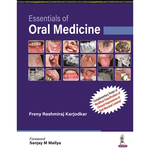 Essentials of Oral Medicine by Freny Rashmiraj Karjodkar, 1st Edition