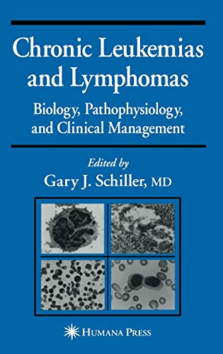 41Vt3SMLWNL._SL500_.jpg Chronic Leukemias And Lymphomas: Biology, Pathophysiology, And Clinical Management Schiller Gary J By Schiller J - Image 1