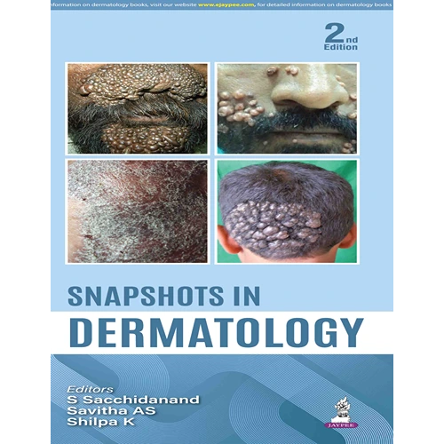 Snapshots in Dermatology by S Sacchindanand, 2nd Edition