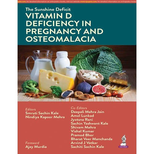 The Sunshine Deficit: Vitamin D Deficiency in Pregnancy and Osteomalacia by Smruti Sachin Kale, 1st Edition